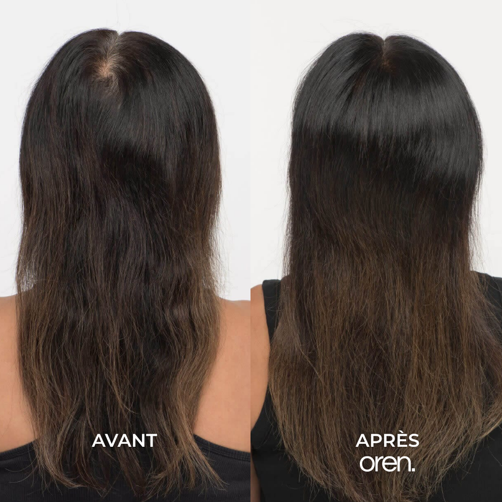 Pépins de Courge Softgels — Anti-DHT Naturel